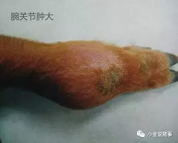 脓包型痤疮怎么治疗,脓包的最佳治疗方法