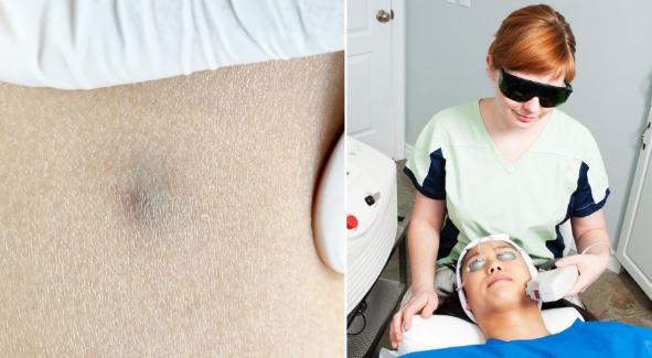 脸上莫名的小颗粒到底是什么？皮肤专家教你护肤