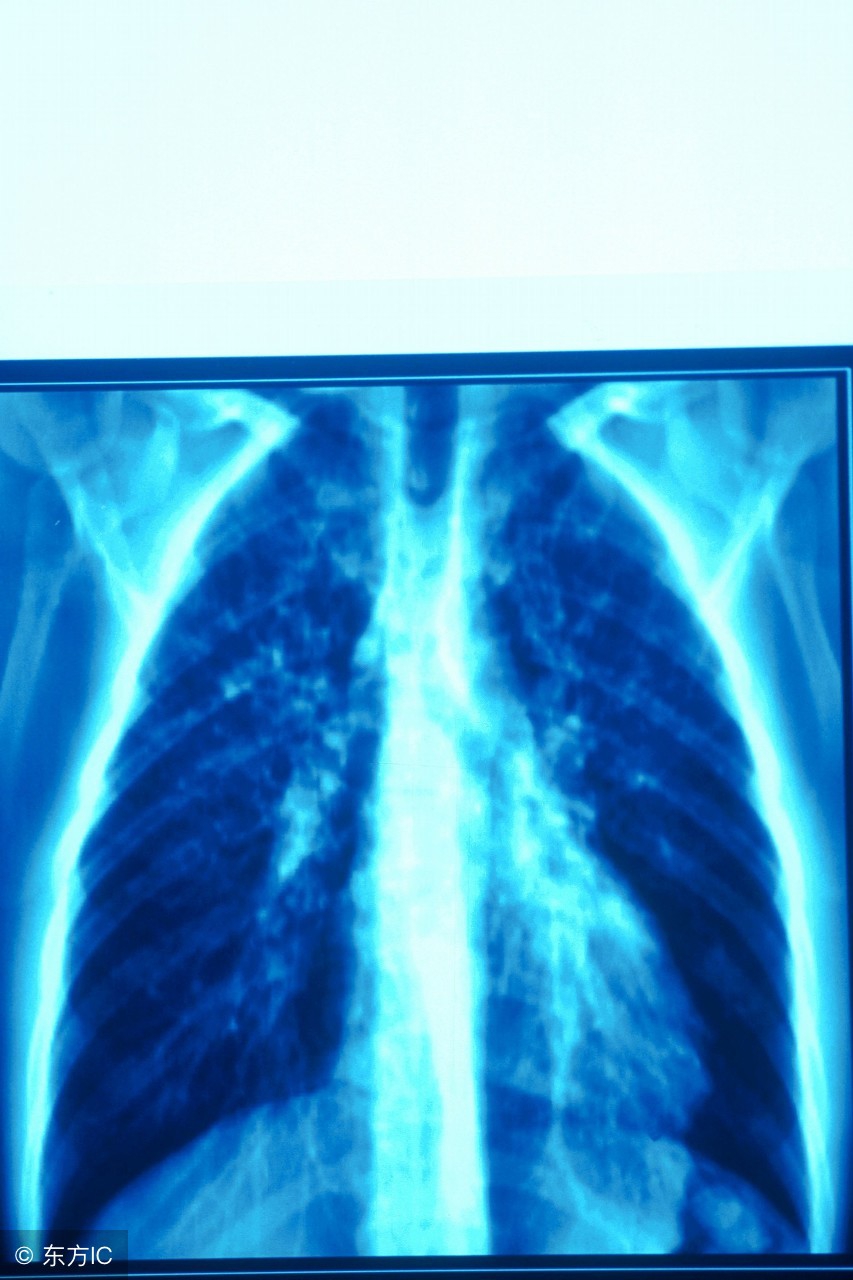 支气管扩张如何保养和预防,支气管扩张伴感染护理查房