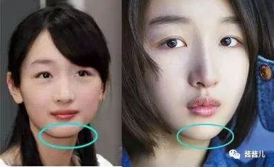 祛水肿护肤仪,护肤瘦脸神器