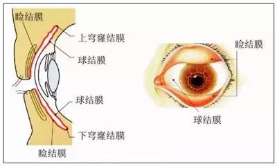 婴儿结膜炎过敏源图片,过敏性结膜炎怎么找过敏原