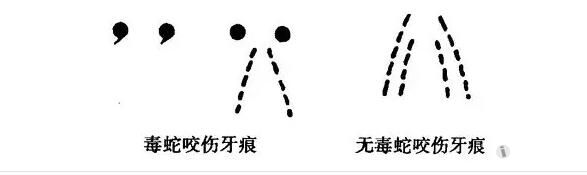 遇到毒蛇怎么办？专业知识还是需要的！