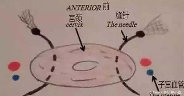12周先兆流产保胎要卧床多久,有胎心胎芽先兆流产保胎成功率