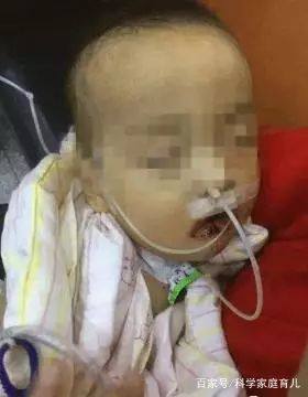 6岁男童误食火碱,男孩误食火碱险丧命