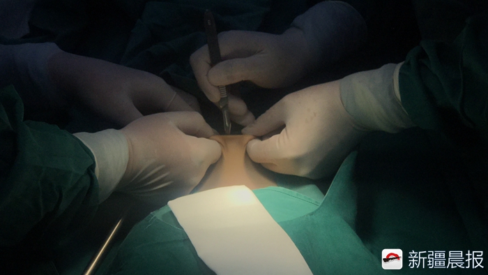 9个月婴儿疝气,疝气手术男童