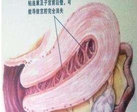 月经量变少可以怎么调理,月经量多怎样才能变少