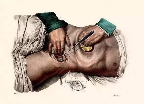 百年残暴治疗史堆砌的事实:同性恋不是病,请放弃治疗