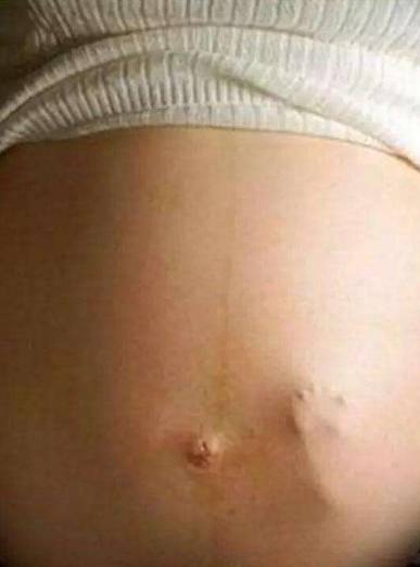 这两天胎动强烈怎么回事,胎动两边拳打脚踢