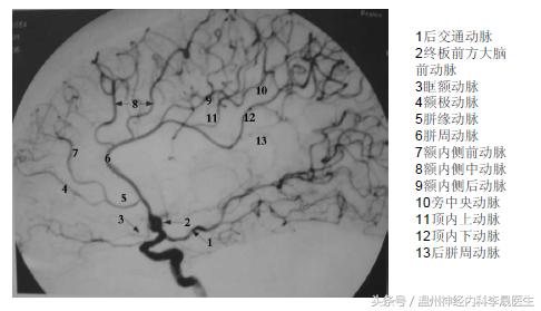 张景明教授讲脑中风后遗症,李医生讲中风视频全集