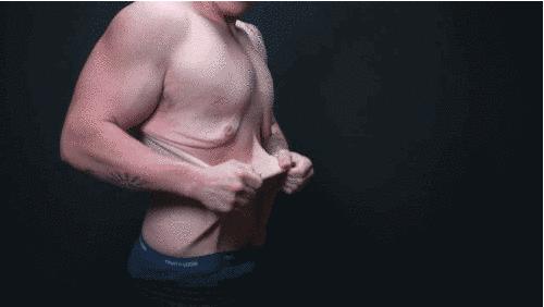 减肥后皮肤松弛靠运动可以紧致吗,胖子减肥后肚子皮肤松弛如何消除