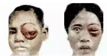 生吃它可以强身健体?这些“民间偏方”真是分分钟要人命!