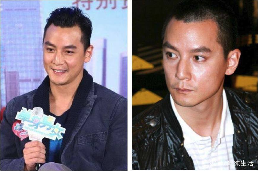 别让秃头误了你的颜值,不要让发际线毁了