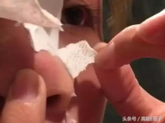 别傻了！蔡徐坤、Angelababy都根治不掉的黑头，微商神器能去除？