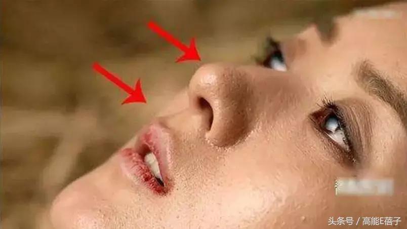 蔡徐坤、Angelababy都根治不掉的黑头，微商神器能去除？