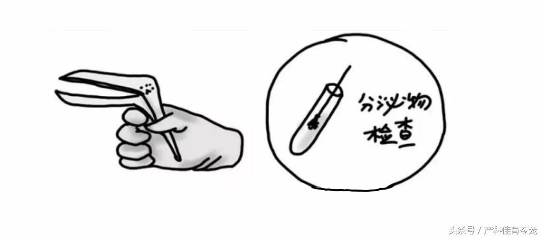 宫颈锥切术后还会得宫颈癌吗,做了宫颈锥切术后还能怀孕吗