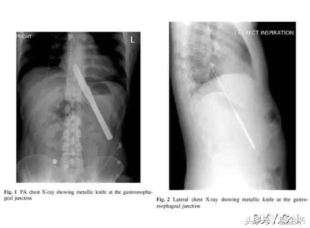 不可思议奇怪的东西,不可思议小物件穿透
