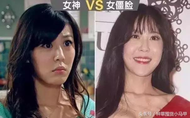 深度剖析医美整形的危害,医美整形该如何避坑呢