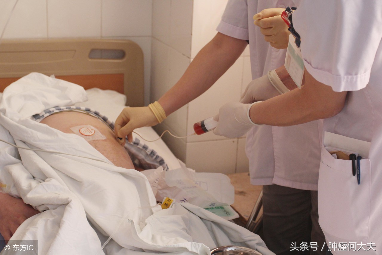 肿瘤晚期腹水怎么消除,癌症晚期腹水腹腔穿刺