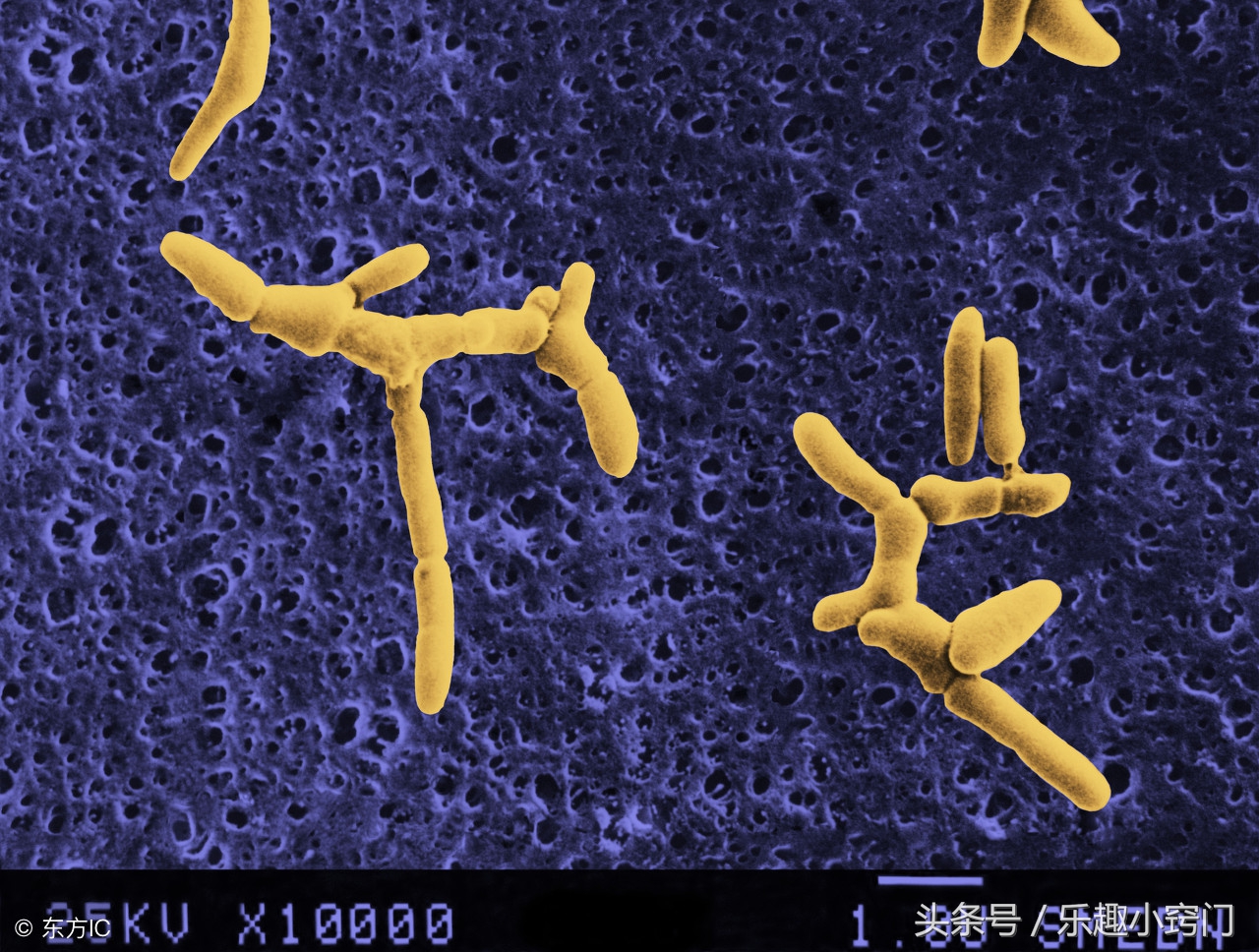 内裤脏不脏需要每天换吗,内裤3天不换有多脏
