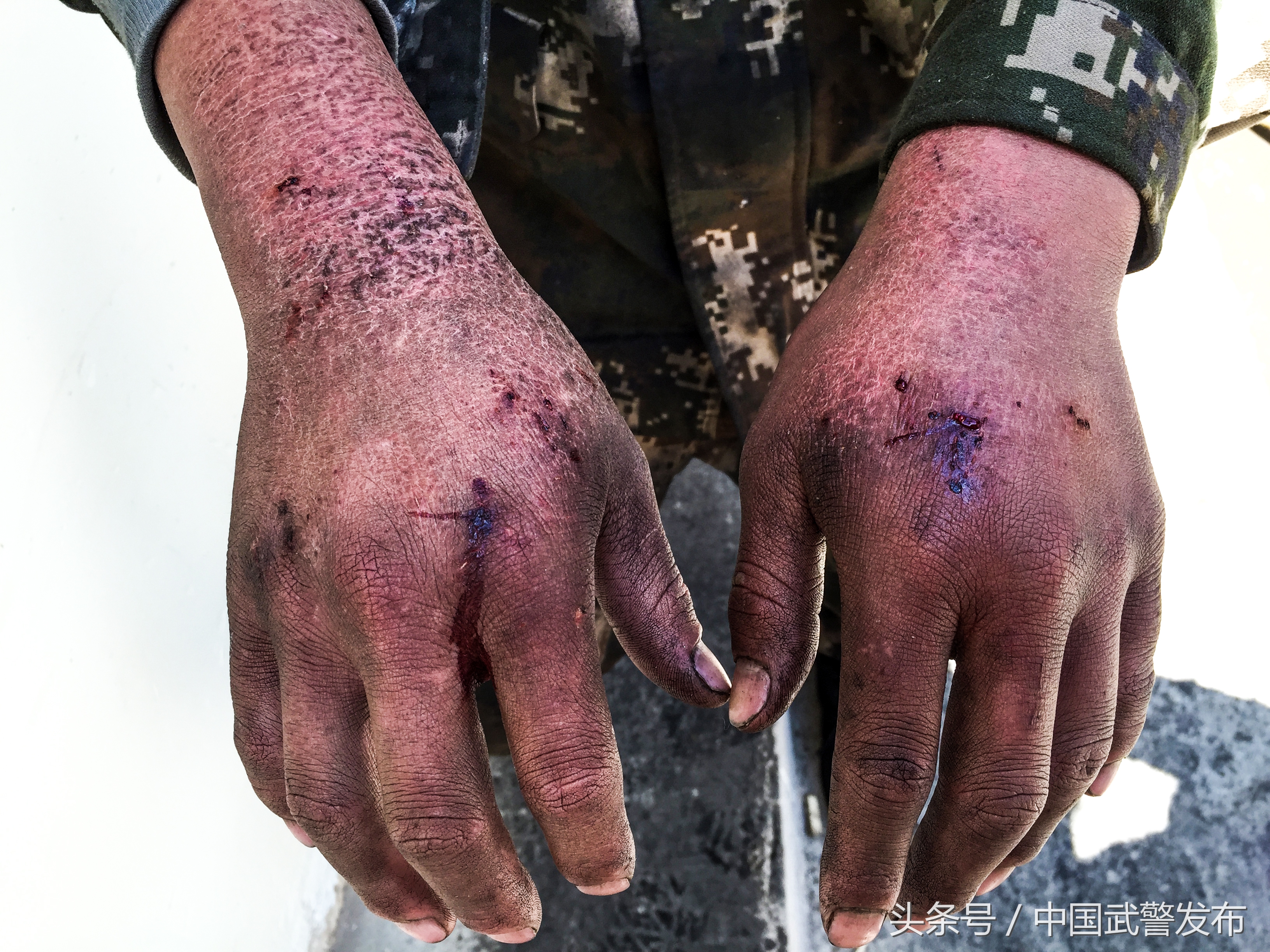 生命之花在雪域高原绽放,青春在雪域高原美丽绽放