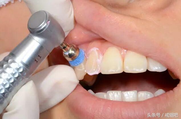 经常吸烟有多可怕,长期吸烟的嘴长什么样