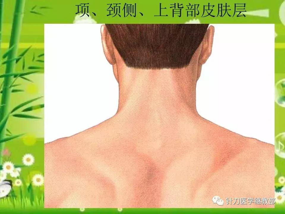 颈椎肌肉损伤用小针刀治疗,针刀治疗颈椎导致神经损伤