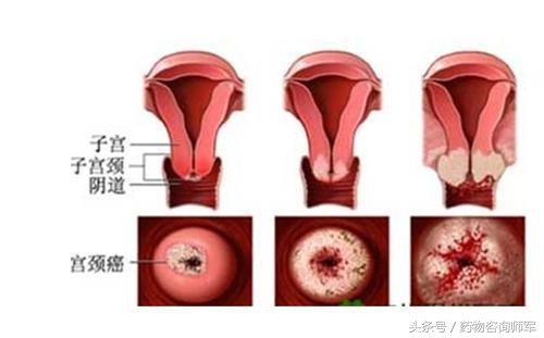 女性妇科检查可以查出有几个男人,35岁女性每隔多久做一次妇科检查