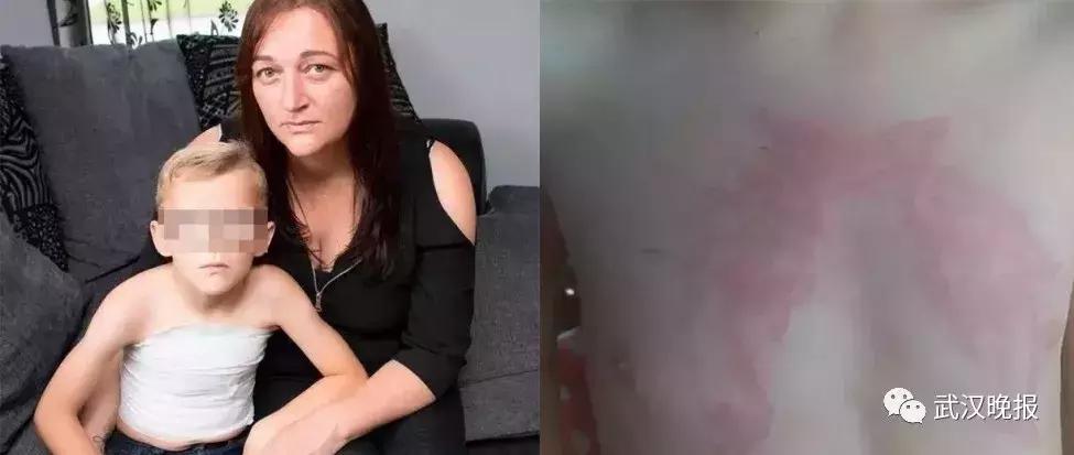 「健康」他在巴厘岛尝鲜特色服务，现在可能一辈子消不掉……悔恨啊！