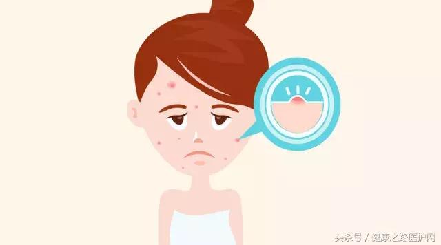 拔黑头粉刺过程细节,挤痘痘和拔黑头手法