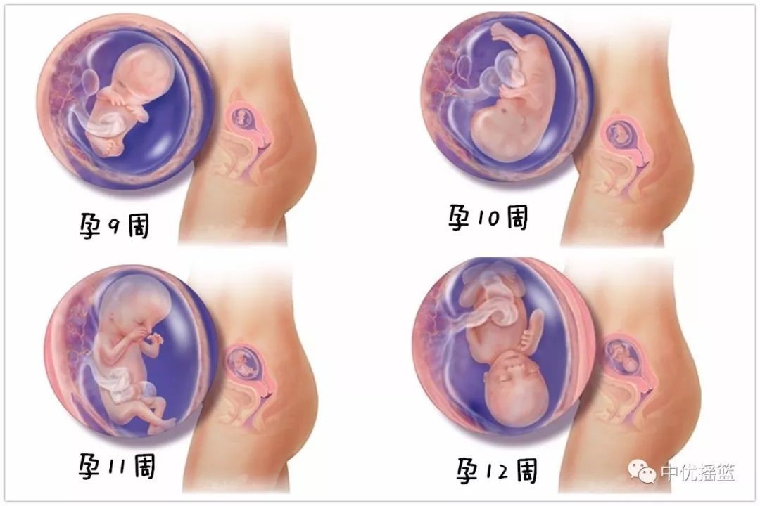 孕妇全身烧伤怎么保住胎儿,孕妇烧伤为保胎拒打止痛药