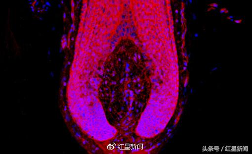 英国新发现:男性脱发用骨质疏松药物“一天就能见成果”