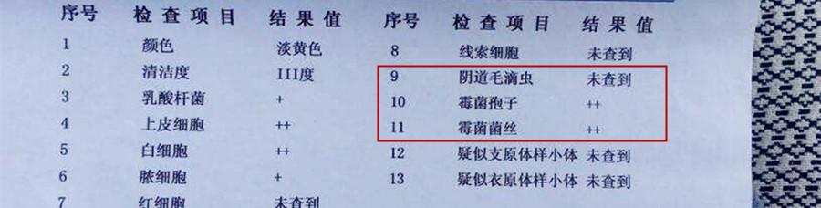 教您全面看懂怀孕检测报告,孕检报告单怎么看是怀孕了