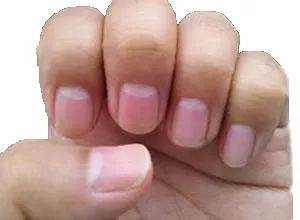 怎么从指甲上看健康图解,从指甲看疾病的图片说明