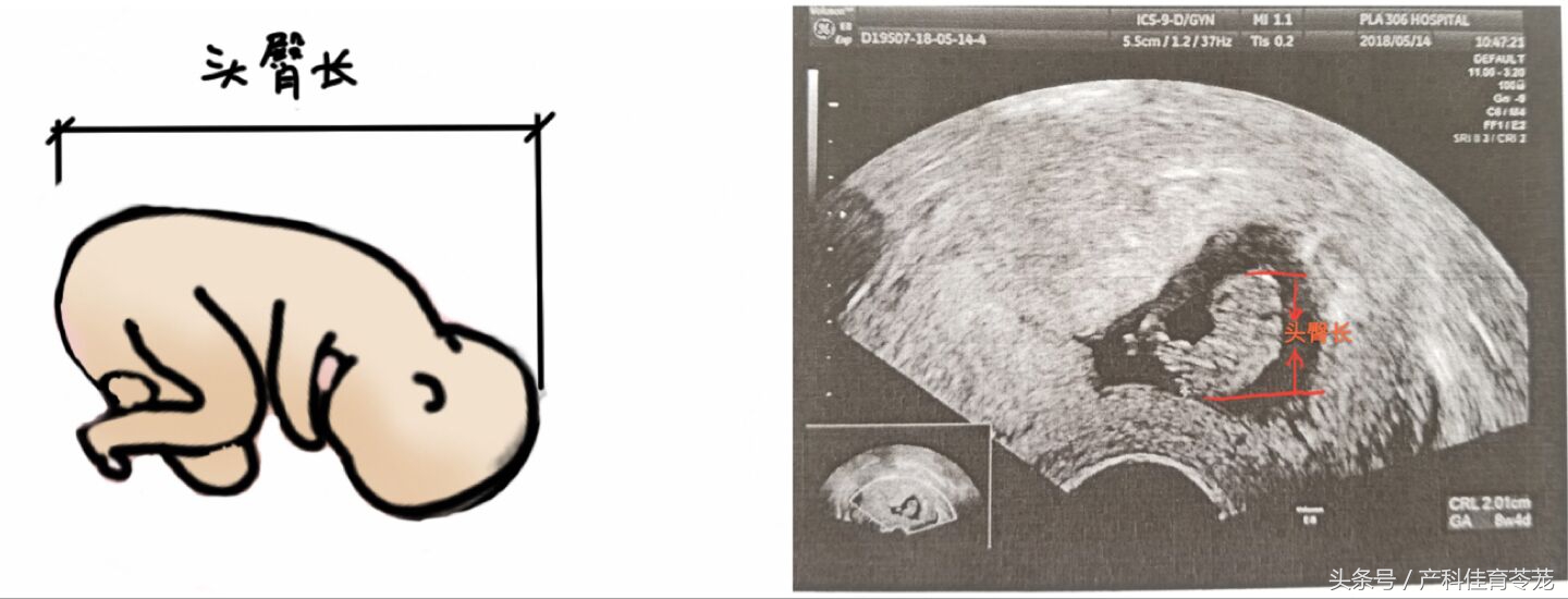 b超的3组数字代表什么,b超图片上的数字