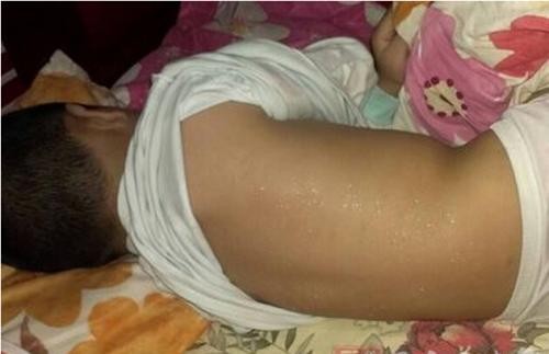 总爱出汗什么意思,容易出汗而且出汗量多是什么原因