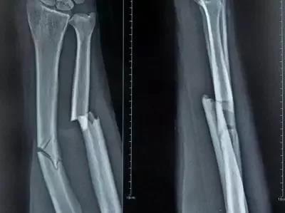 健康知识及急救技能科普知识,健康知识科普救治护理