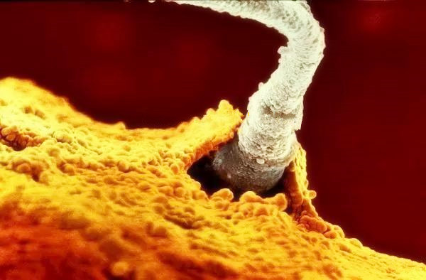 早期怀孕10天的表现,女人刚怀孕怎么发现的