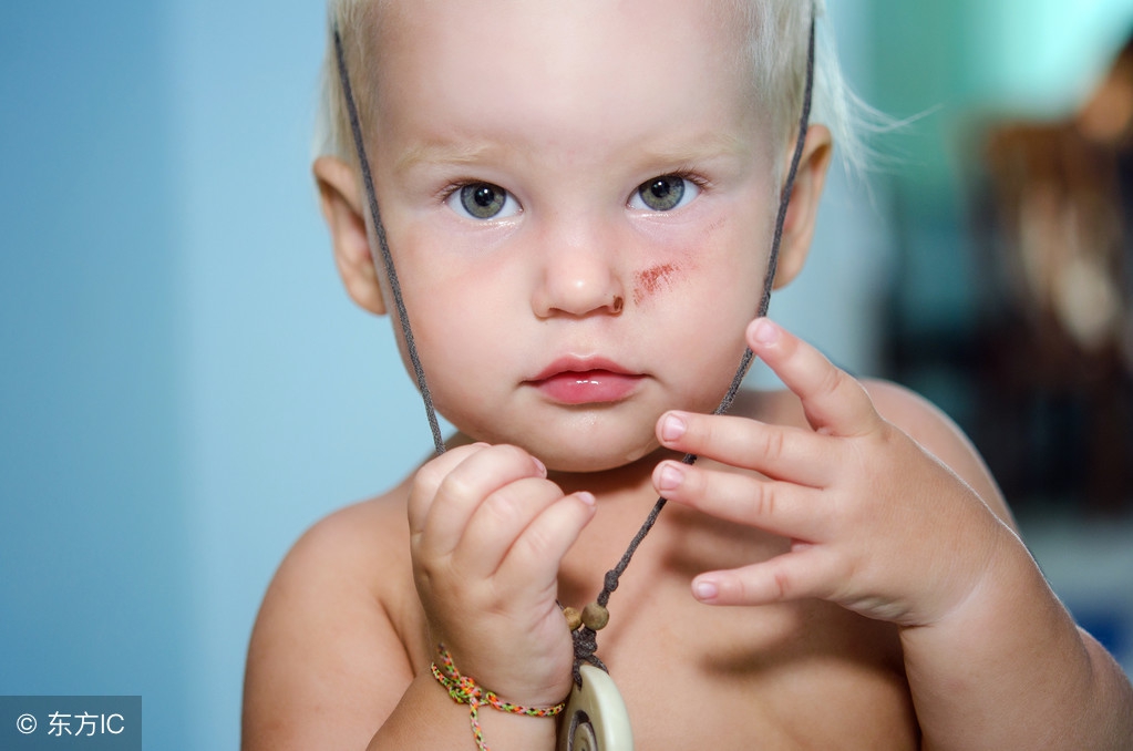 受伤了留疤了怎样消除疤痕,受伤后如何护理才能避免留疤