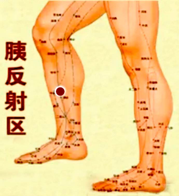 现在糖尿病最有可能治愈的方法,糖尿病不再打针吃药
