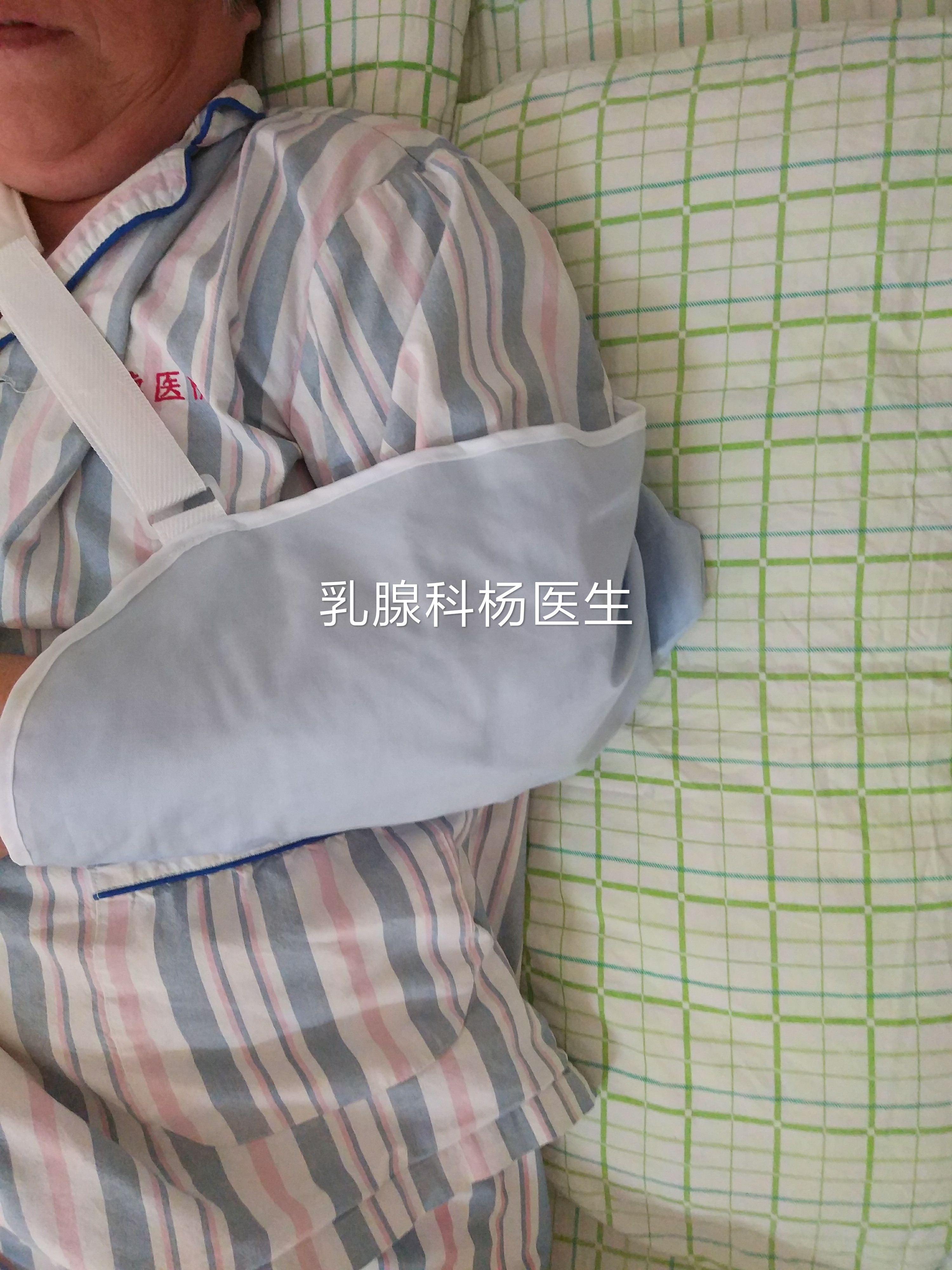 乳腺癌从手术到化疗要多长时间,乳腺癌整个过程多长时间