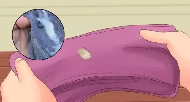 下身白带多黏黏的是怎么回事,下身老是有黏黏的白带