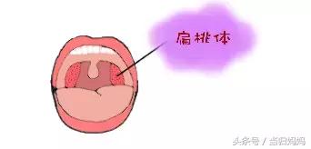 扁桃体肿大喝什么茶好,扁桃体肿大有什么危害