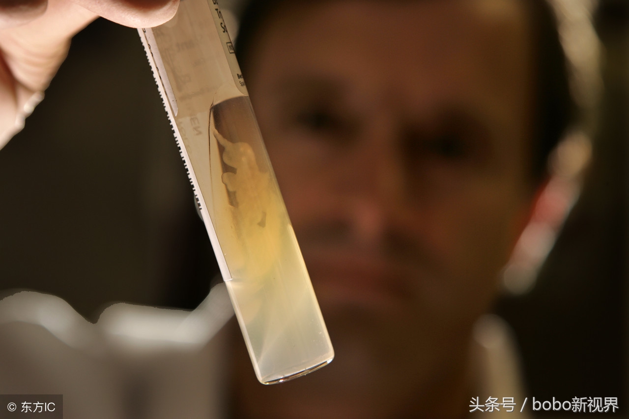 也许你还不知道，你整天拿在手里的手机已经成为了病菌聚集地