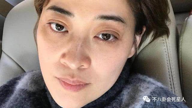 关晓彤鞠婧祎长得矮,黑眼圈眼袋关晓彤