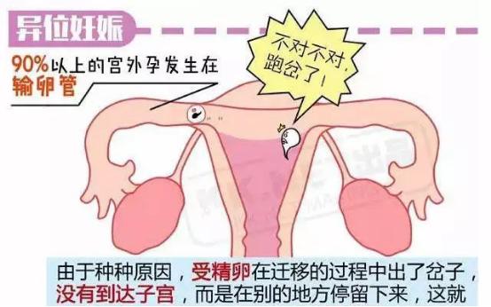 孕妈怎样才能知道胎儿有危险,发现怀孕孕妇要注意什么