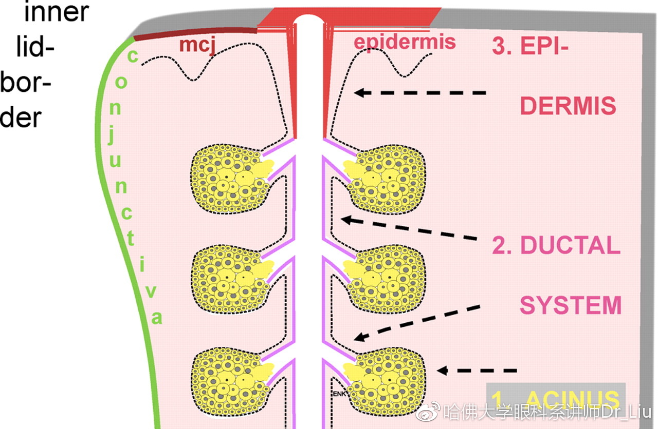 睑板腺功能障碍是干眼症吗,睑板腺功能障碍中医怎么讲