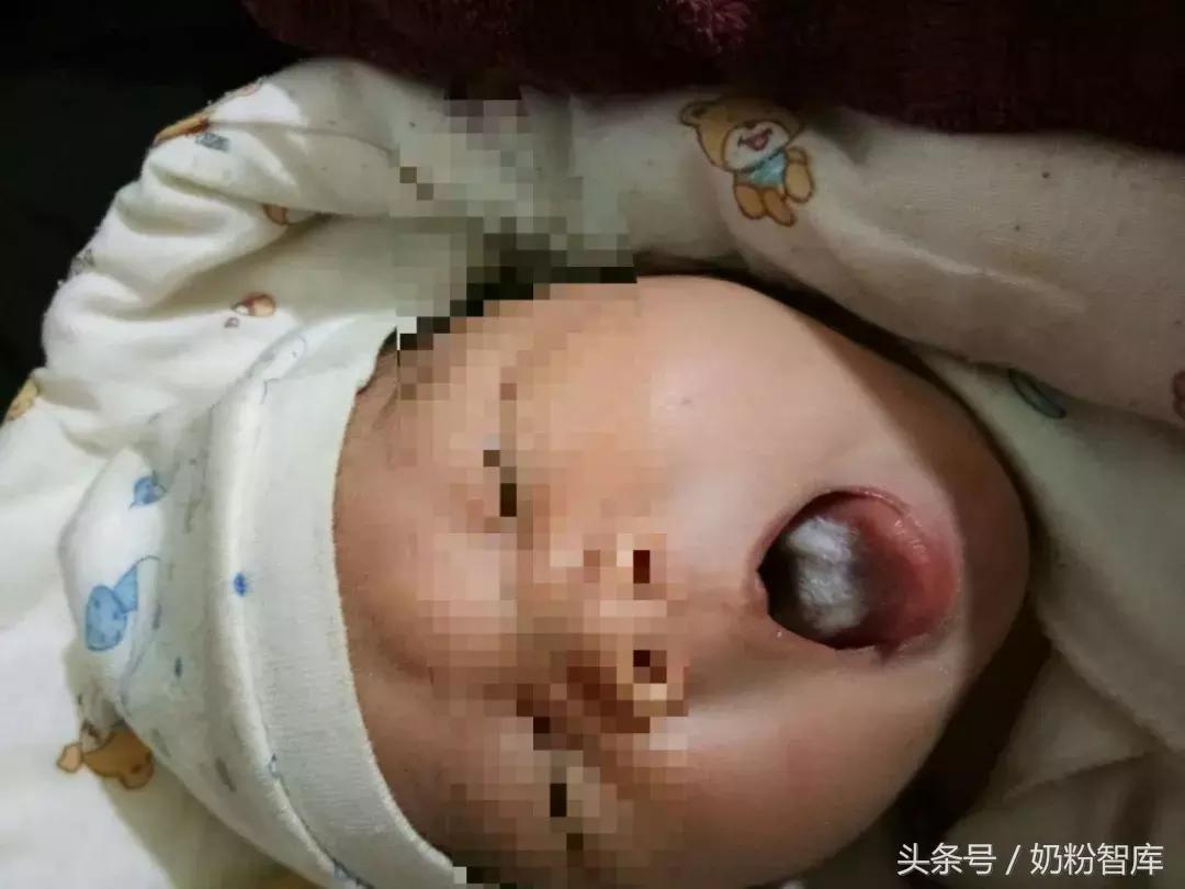 宝宝舌苔又厚又白还有红点,2岁宝宝舌苔白厚积食了怎么办