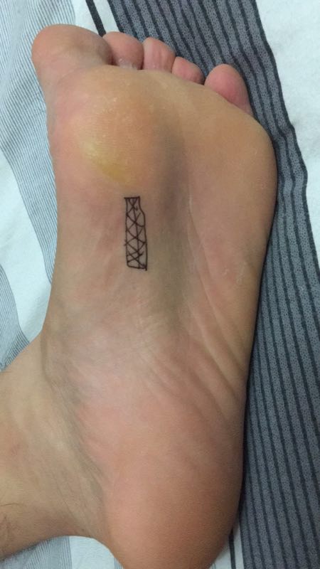 蔡赟答疑-35:增强足底力量根治筋膜炎