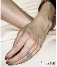 像蚯蚓一样的凸起的纹,像蚯蚓一样黑色的是什么