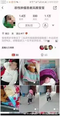 视网膜母细胞瘤会瞳孔散大吗,视网膜母细胞瘤出现白瞳了怎么治